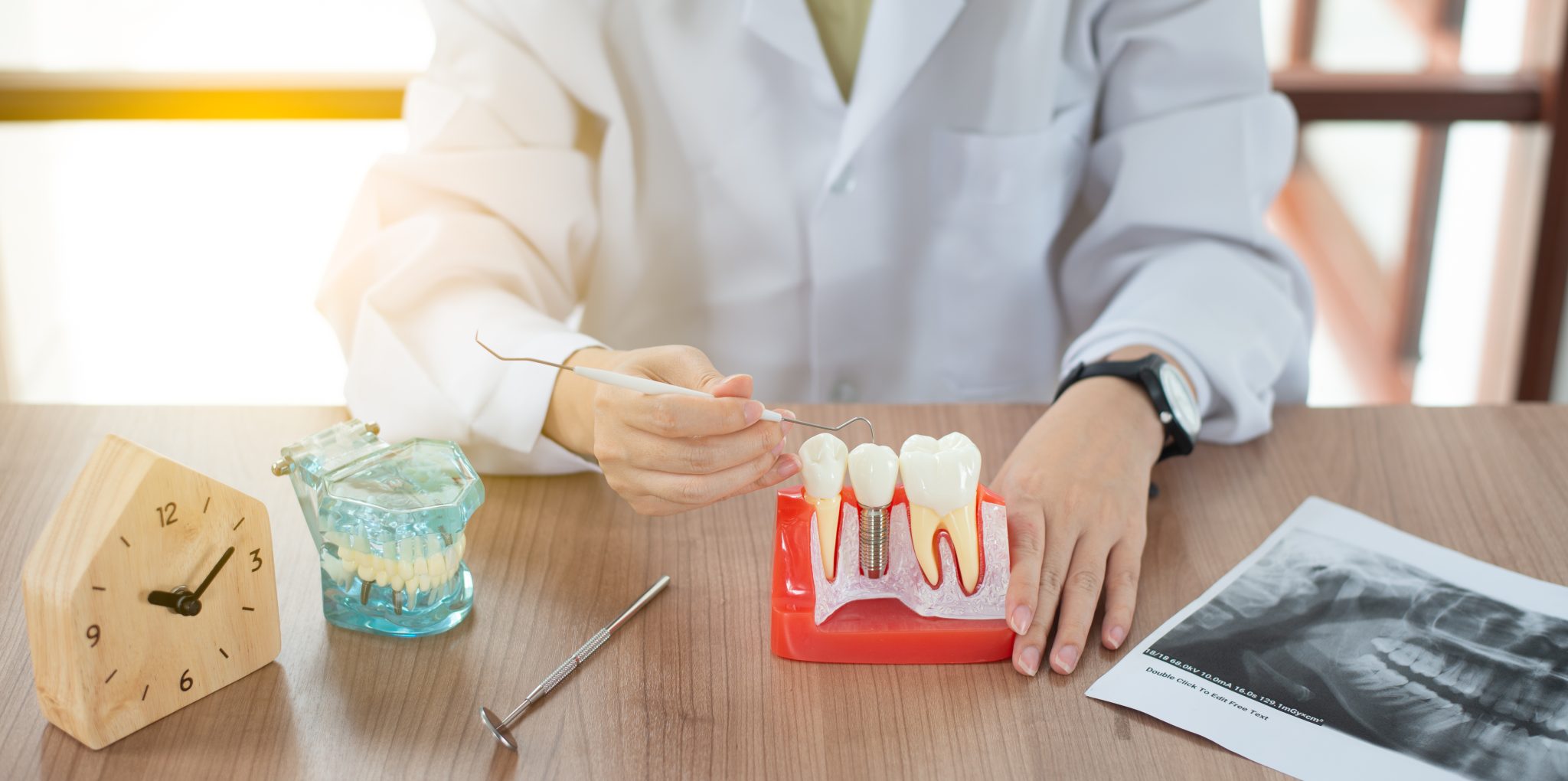 Understanding Recovery Time for Dental Implant Surgery The Road to